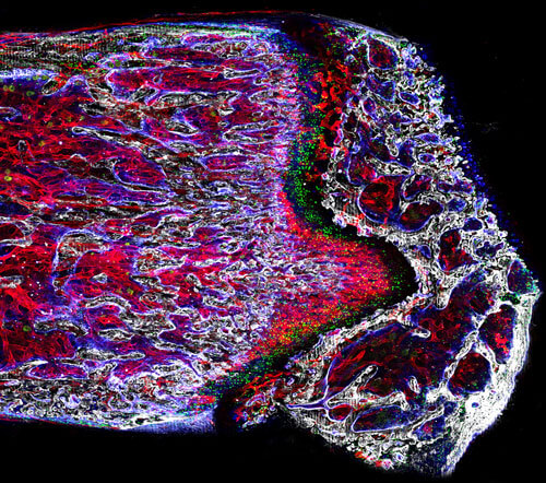 Bone Research Gets A Break At The Ottawa Hospital The Ottawa Hospital 