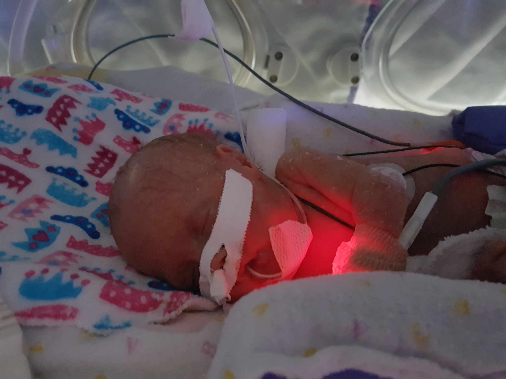 Baby in NICU