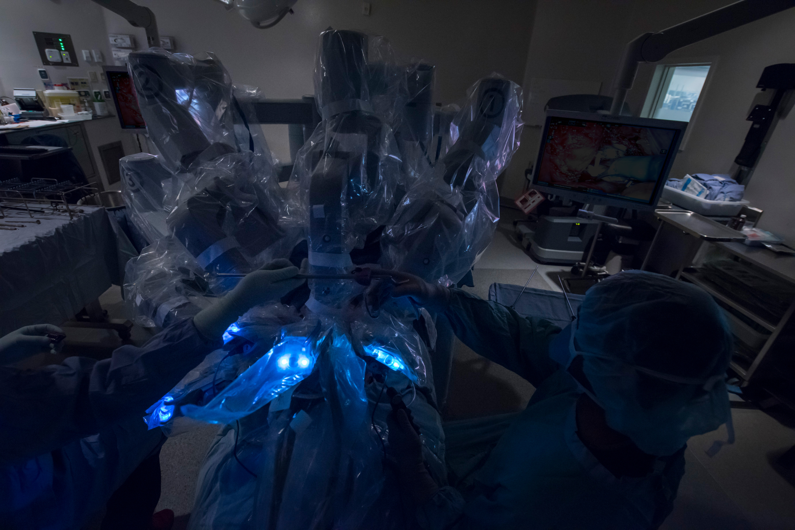 The da Vinci Surgical System is a state-of-the-art robotic system