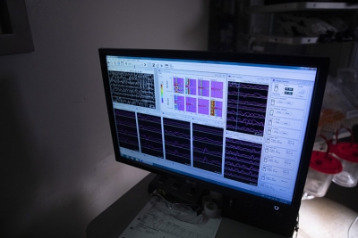 A computer monitors the status of a patient's optic nerve during a surgery at The Ottawa Hospital.