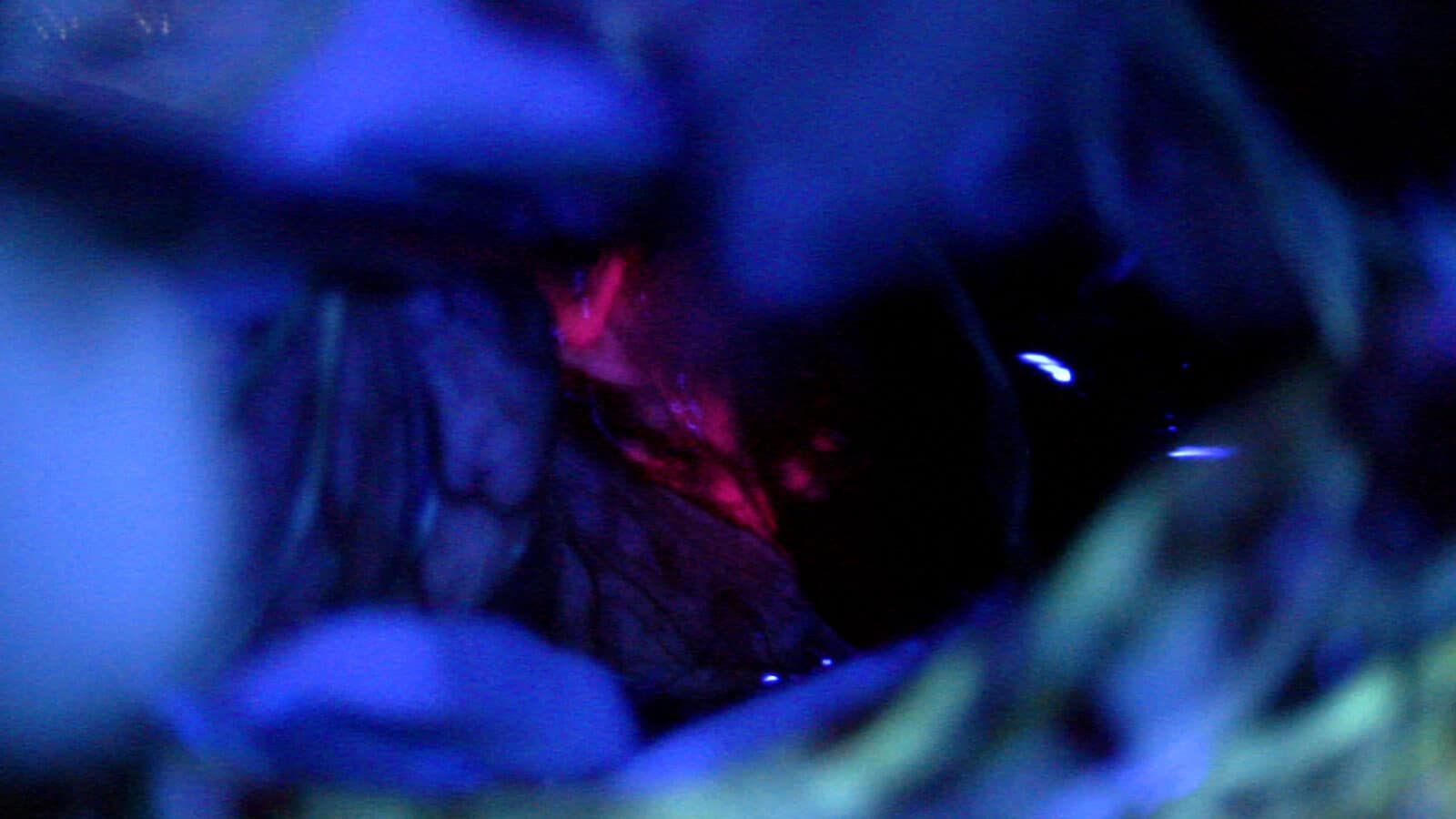 All about fluorescence-guided surgery and 5-ALA