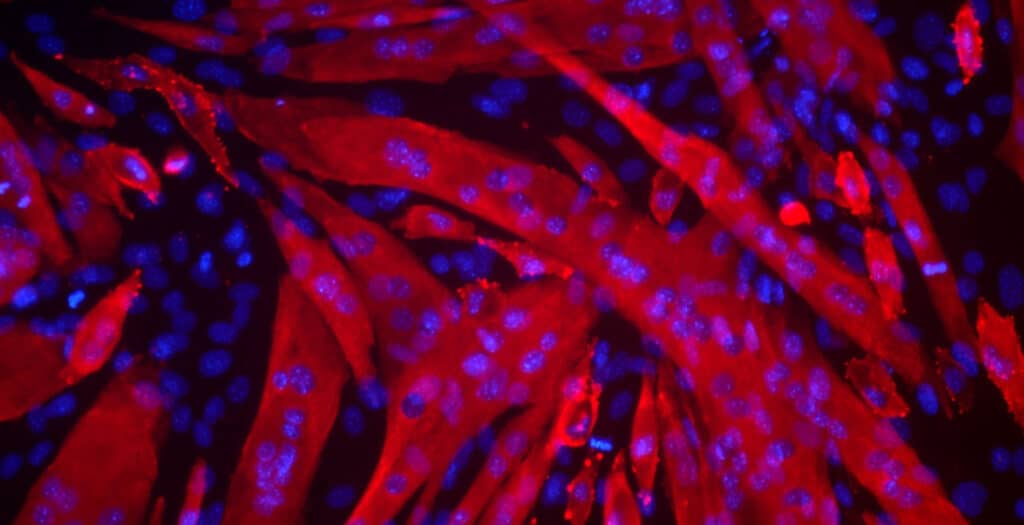 AIRWeb Misc Stemcell — Your Impact 2026