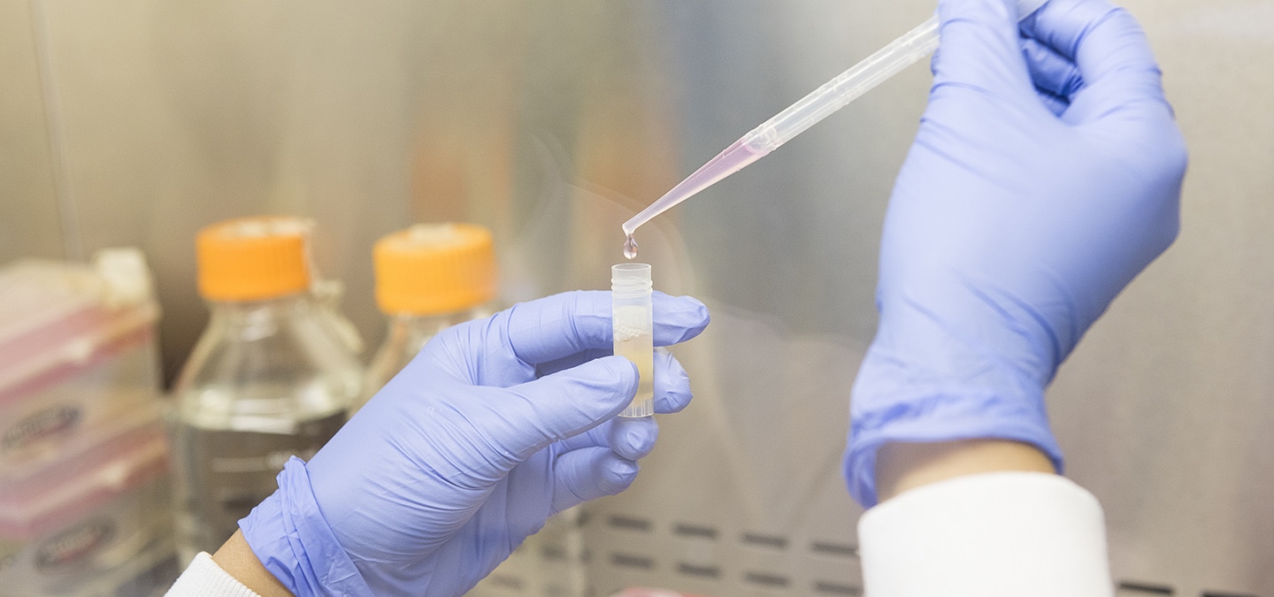 COVID Research — Dr. Taha Azad