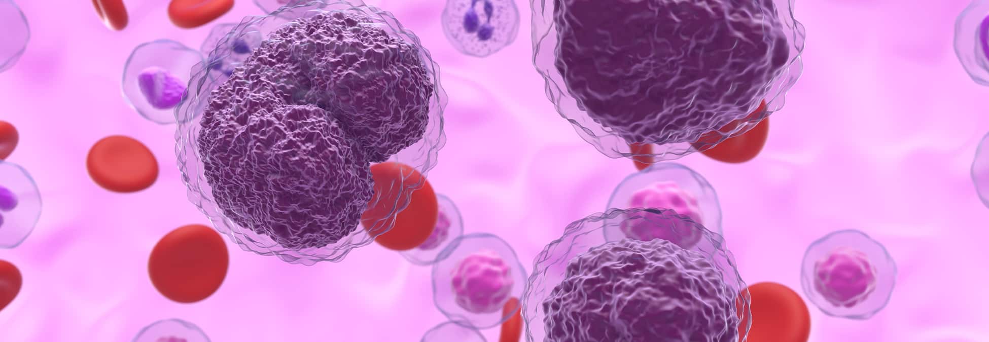 Non Hodgkin Lymphoma — All about non-Hodgkin lymphoma