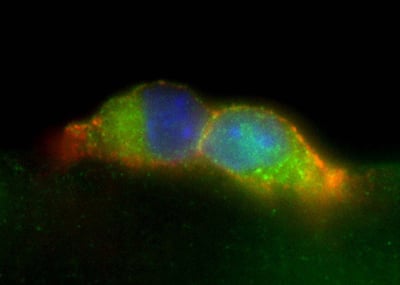 Stem cell